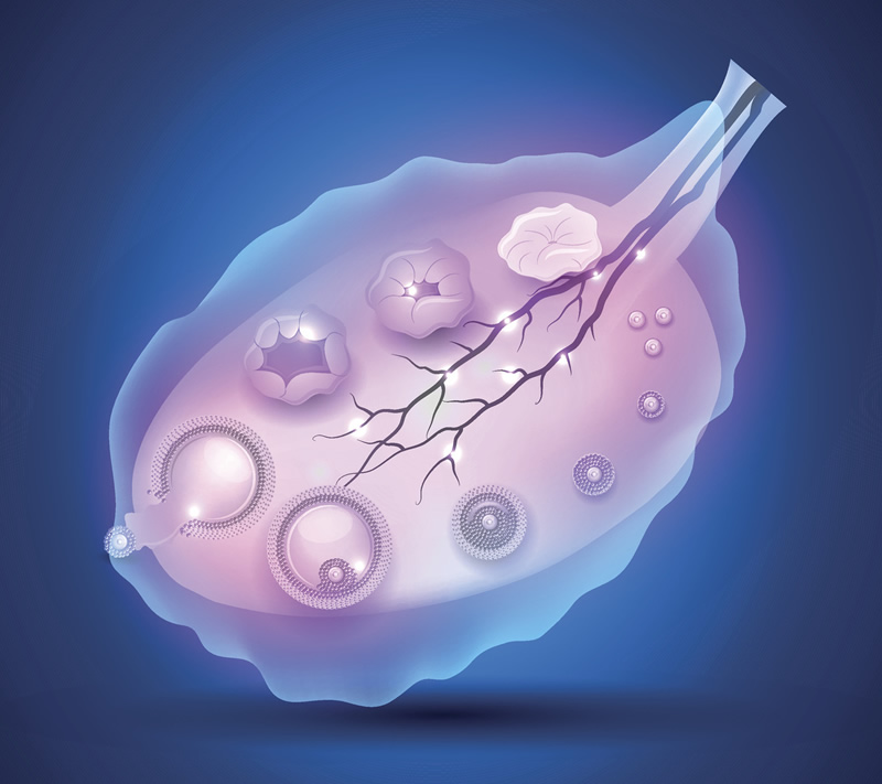 2026在东阳市罗氏易位能做三代试管婴儿生子吗？，相互易位和罗氏易位有什么区别？